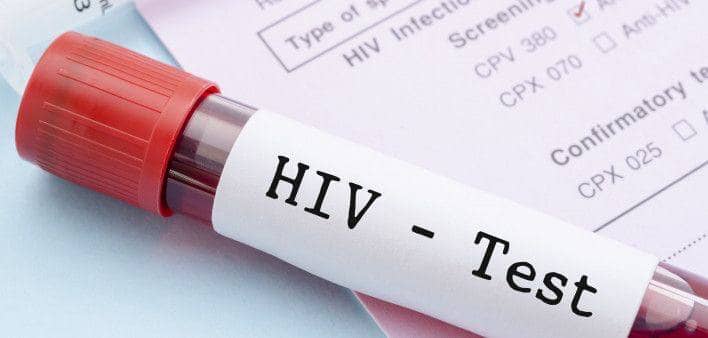 آزمایش تشخیص HIV چیست؟